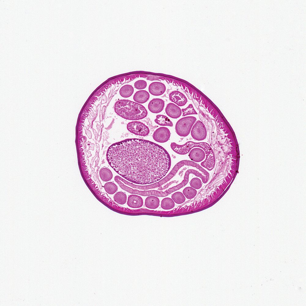 Slide Of Ascaris Ovary – Skyline Educational Labs